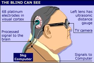 The electronic prosthesis of Jerry's eyes and brain (Dobelle 2000)